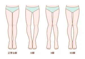 様々な脚タイプ