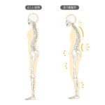 反り腰のイメージ