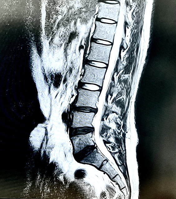 レントゲンの様子