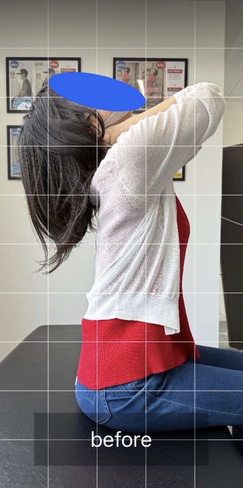 NAORU整体 町田院　before１