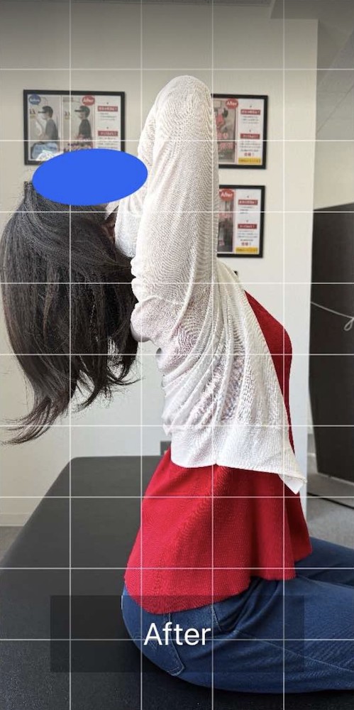 NAORU整体 町田院　after１