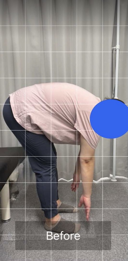 NAORU整体 町田院　before３