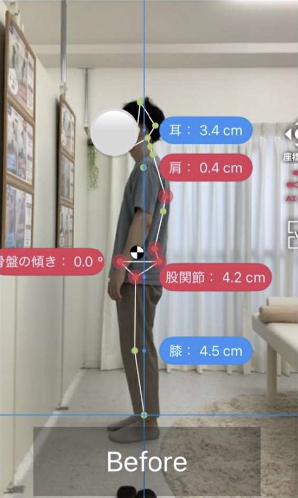 NAORU整体 北千住院 before1