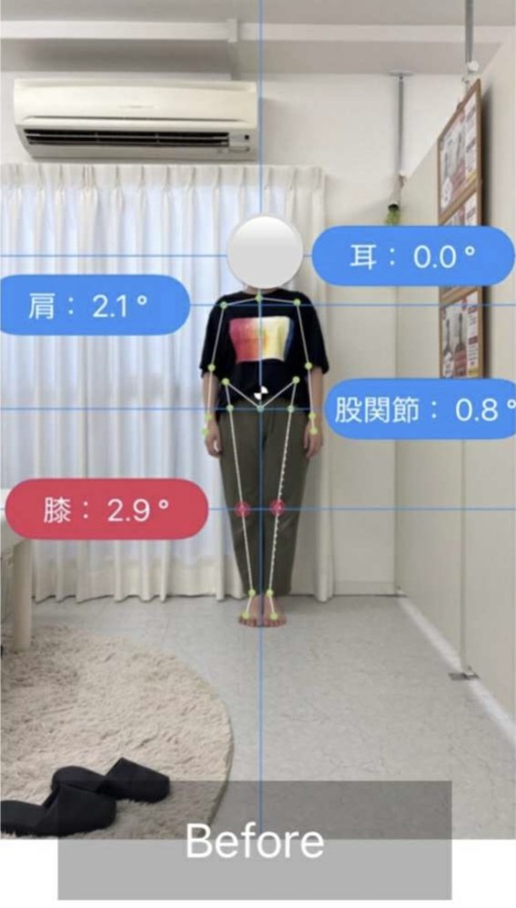 NAORU整体 北千住院　before２