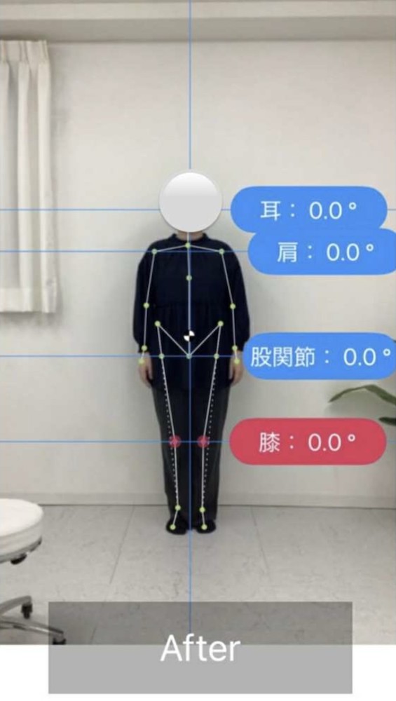 NAORU整体 北千住院　after２