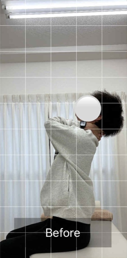 NAORU整体 北千住院　before３