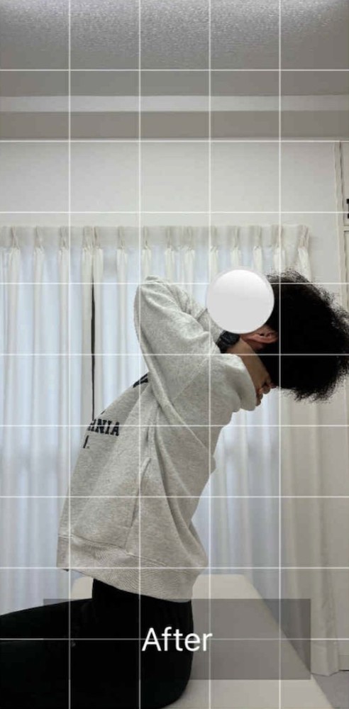 NAORU整体 北千住院　after３