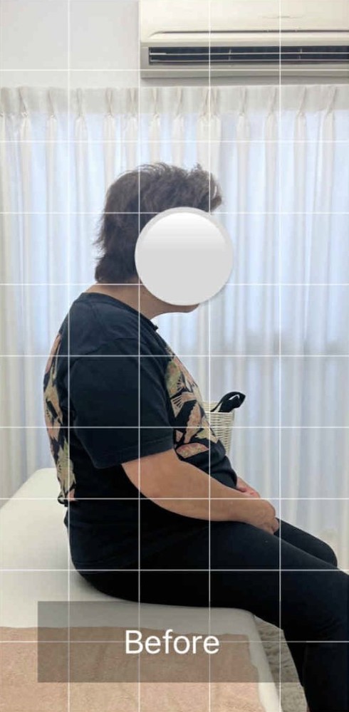 NAORU整体 北千住院　before４