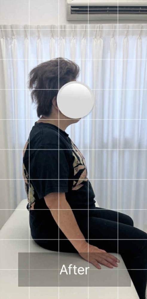 NAORU整体 北千住院　after４